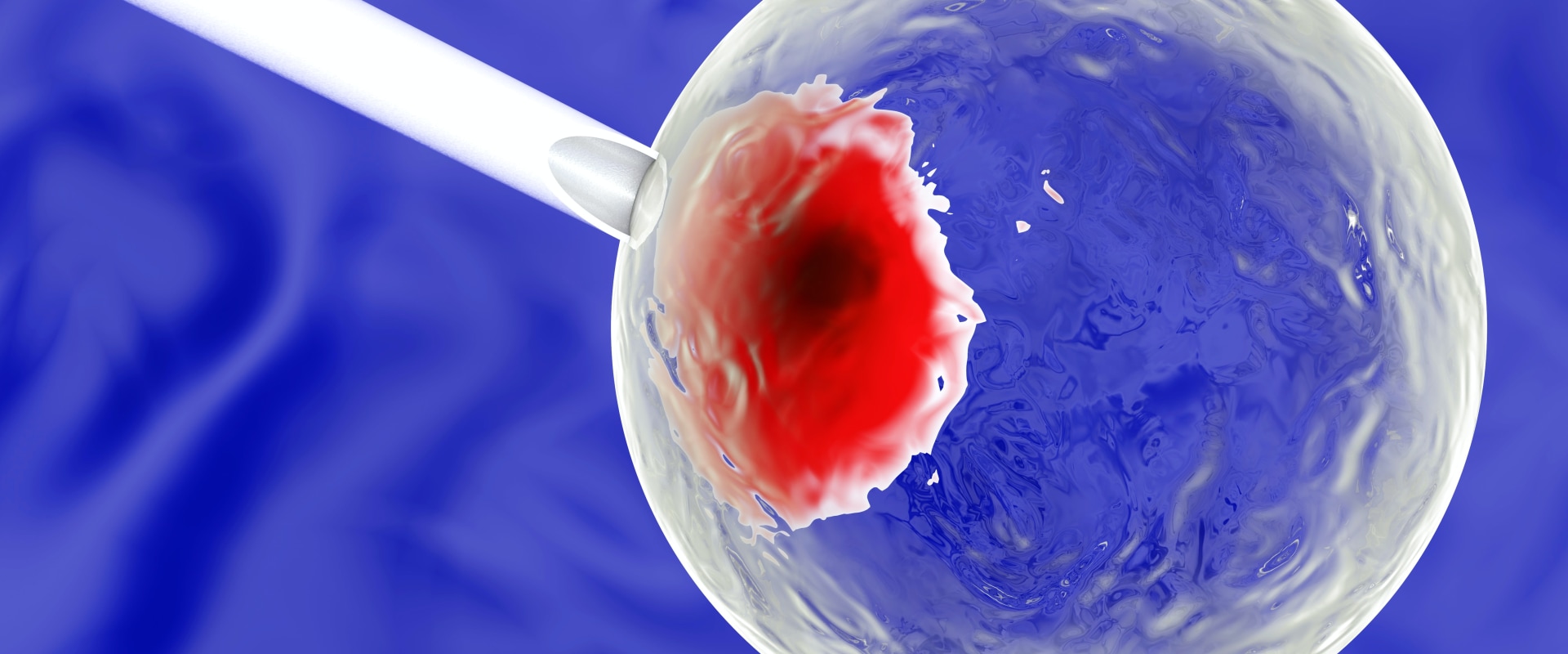Are stem cells a miracle cure?