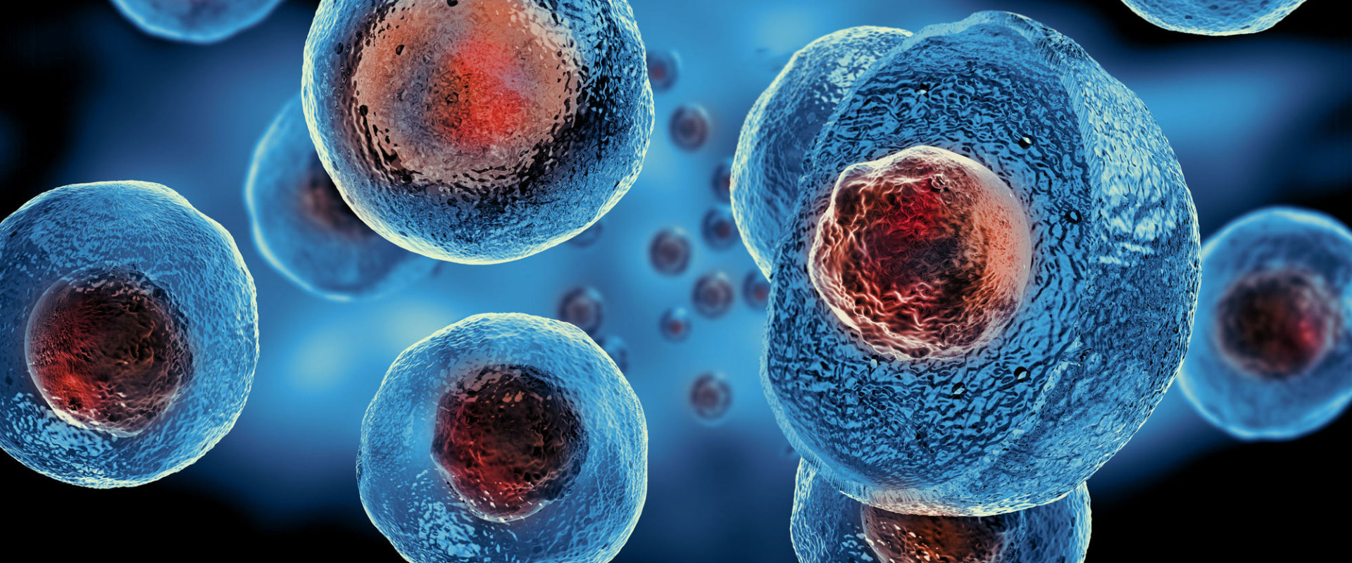 What is the most common stem cell therapy?