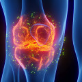 Will stem cell therapy help osteoarthritis?