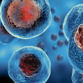 What is the most common stem cell therapy?