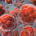 The Current State of Stem Cell Therapy: An Expert's Perspective