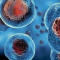 Is stem cell therapy successful?