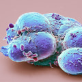 Can stem cell treatment cause problems?