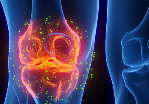 Does Stem Cell Therapy work to heal knees?