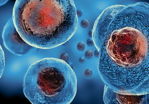 What is the most common stem cell therapy?