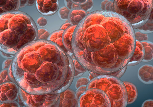 Does insurance cover stem cell therapy?