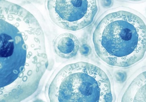 What are the 4 types of stem cell therapy?